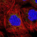 BTN2A2 Antibody in Immunocytochemistry (ICC/IF)