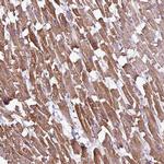 BTN2A2 Antibody in Immunohistochemistry (Paraffin) (IHC (P))