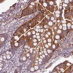 BTN2A2 Antibody in Immunohistochemistry (Paraffin) (IHC (P))