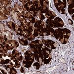 NDST2 Antibody in Immunohistochemistry (Paraffin) (IHC (P))