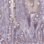 MAN1B1 Antibody in Immunohistochemistry (IHC)