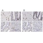 ADAR Antibody in Immunohistochemistry (IHC)