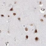 ADAR Antibody in Immunohistochemistry (IHC)