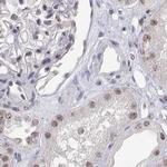 ADAR Antibody in Immunohistochemistry (IHC)