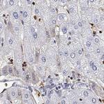 ADAR Antibody in Immunohistochemistry (IHC)