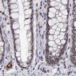 ADAR Antibody in Immunohistochemistry (IHC)