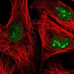 ADAR Antibody in Immunocytochemistry (ICC/IF)