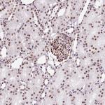 LUC7L2 Antibody in Immunohistochemistry (Paraffin) (IHC (P))