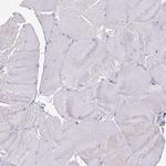 HOXC13 Antibody in Immunohistochemistry (Paraffin) (IHC (P))