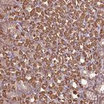 Arp3 Antibody in Immunohistochemistry (Paraffin) (IHC (P))