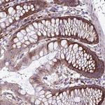 RPL13 Antibody in Immunohistochemistry (Paraffin) (IHC (P))