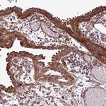 RPL13 Antibody in Immunohistochemistry (Paraffin) (IHC (P))