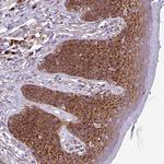 RPL13 Antibody in Immunohistochemistry (Paraffin) (IHC (P))