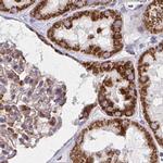 NFS1 Antibody in Immunohistochemistry (IHC)