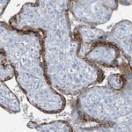 GAMT Antibody in Immunohistochemistry (Paraffin) (IHC (P))