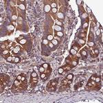 PAFAH1B2 Antibody in Immunohistochemistry (Paraffin) (IHC (P))