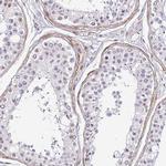 TMEM119 Antibody in Immunohistochemistry (IHC)