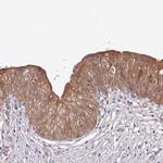 Ly-108 Antibody in Immunohistochemistry (Paraffin) (IHC (P))