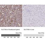 SLC7A8 Antibody in Immunohistochemistry (IHC)