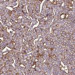 SLC7A8 Antibody in Immunohistochemistry (IHC)