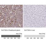 SLC7A8 Antibody