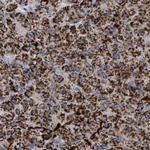 SUCLG2 Antibody in Immunohistochemistry (IHC)