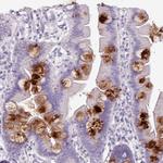 OR2T10 Antibody in Immunohistochemistry (Paraffin) (IHC (P))