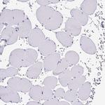 MUC21 Antibody in Immunohistochemistry (IHC)