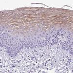 MUC21 Antibody in Immunohistochemistry (IHC)