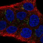 DAB1 Antibody in Immunocytochemistry (ICC/IF)