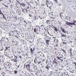 DAB1 Antibody in Immunohistochemistry (Paraffin) (IHC (P))