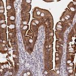 DAB1 Antibody in Immunohistochemistry (Paraffin) (IHC (P))