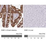 DAB1 Antibody in Immunohistochemistry (IHC)