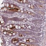 OGFOD3 Antibody in Immunohistochemistry (Paraffin) (IHC (P))