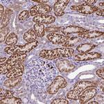 MGAT4B Antibody in Immunohistochemistry (Paraffin) (IHC (P))