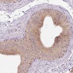 VPS25 Antibody in Immunohistochemistry (IHC)