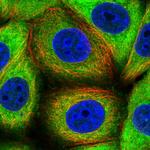 CSDE1 Antibody in Immunocytochemistry (ICC/IF)