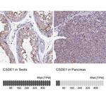 CSDE1 Antibody in Immunohistochemistry (IHC)