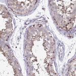 CSDE1 Antibody in Immunohistochemistry (IHC)