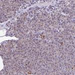 CSDE1 Antibody in Immunohistochemistry (IHC)