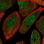 OIP5 Antibody in Immunocytochemistry (ICC/IF)