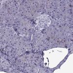 OIP5 Antibody in Immunohistochemistry (Paraffin) (IHC (P))