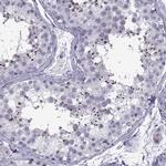 OIP5 Antibody in Immunohistochemistry (IHC)