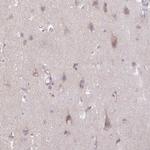 SLC38A1 Antibody in Immunohistochemistry (Paraffin) (IHC (P))