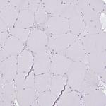 SLC38A1 Antibody in Immunohistochemistry (Paraffin) (IHC (P))