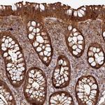 ARPIN Antibody in Immunohistochemistry (IHC)