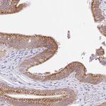 TRAF4 Antibody in Immunohistochemistry (IHC)