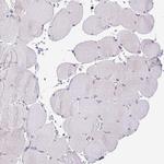 TRAF4 Antibody in Immunohistochemistry (IHC)