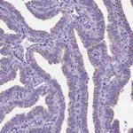 TTLL6 Antibody in Immunohistochemistry (Paraffin) (IHC (P))