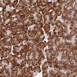 APOLD1 Antibody in Immunohistochemistry (Paraffin) (IHC (P))